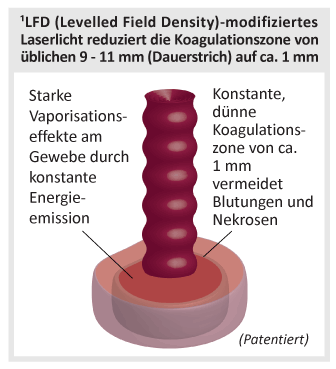 Erklärung des LFD (Levelled Field Density)-Modus